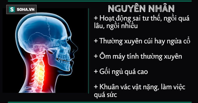 10 cấp độ thoái hóa đốt sống cổ: Hãy xem bạn bị mức mấy để xử lý trước khi bệnh nặng lên - Ảnh 1. 10 cấp độ thoái hóa đốt sống cổ: Hãy xem bạn bị mức mấy để xử lý trước khi bệnh nặng lên - Ảnh 1.