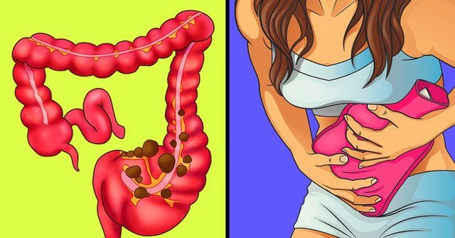7 cách hiệu quả để giảm đau dạ dày và táo bón mà không cần đến thuốc giảm đau - Ảnh 1. 7 cách hiệu quả để giảm đau dạ dày và táo bón mà không cần đến thuốc giảm đau - Ảnh 1.