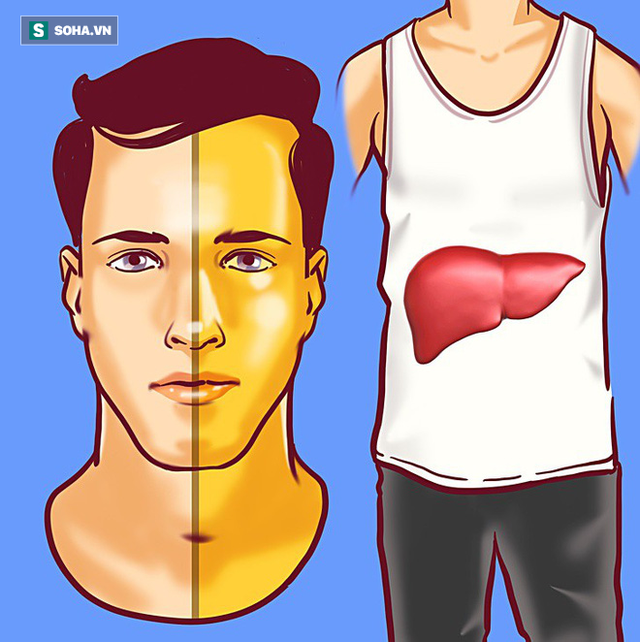 8 dấu hiệu cảnh báo bệnh gan: Nếu có triệu chứng là bạn cần đến bác sĩ càng sớm càng tốt - Ảnh 1. 8 dấu hiệu cảnh báo bệnh gan: Nếu có triệu chứng là bạn cần đến bác sĩ càng sớm càng tốt - Ảnh 1.