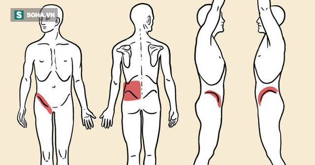 5 dấu hiệu thận của bạn kêu cứu vì có sỏi: Đừng để sỏi tăng kích thước sẽ rất phức tạp - Ảnh 1. 5 dấu hiệu thận của bạn kêu cứu vì có sỏi: Đừng để sỏi tăng kích thước sẽ rất phức tạp - Ảnh 1.