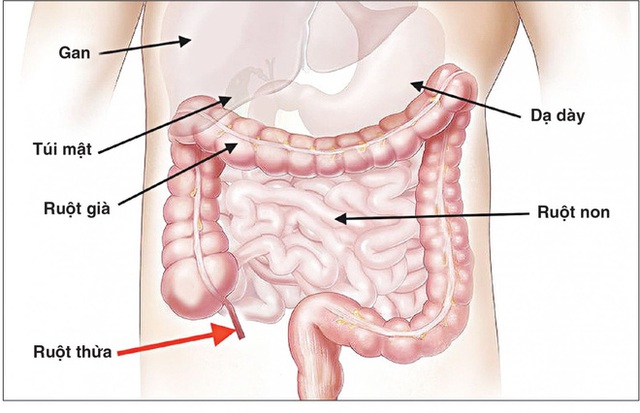 Đau bụng kèm sốt, chán ăn: Cẩn thận với căn bệnh có thời gian vàng cấp cứu chỉ 6 giờ, để lâu nhiều biến chứng - Ảnh 1. Đau bụng kèm sốt, chán ăn: Cẩn thận với căn bệnh có thời gian vàng cấp cứu chỉ 6 giờ, để lâu nhiều biến chứng - Ảnh 1.