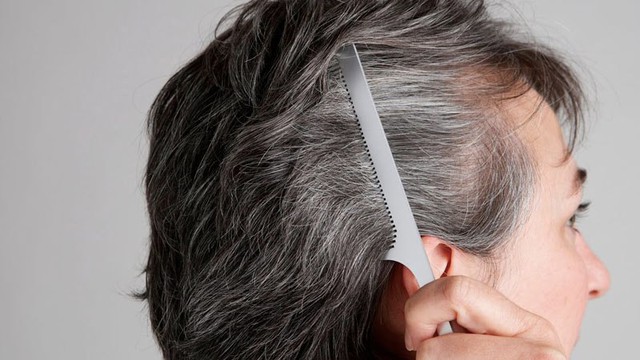 Ngày càng nhiều tóc trắng, có nên nhổ hay không? Sau 35 tuổi, nhất định phải lưu ý 2 điều mới tránh xa nguy cơ tóc bạc sớm - Ảnh 1. Ngày càng nhiều tóc trắng, có nên nhổ hay không? Sau 35 tuổi, nhất định phải lưu ý 2 điều mới tránh xa nguy cơ tóc bạc sớm - Ảnh 1.