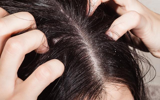 Ngứa da dầu, người đàn ông qua đời sau 3 tháng: 4 cơn ngứa cảnh báo bệnh nặng hoặc ung thư - Ảnh 1. Ngứa da dầu, người đàn ông qua đời sau 3 tháng: 4 cơn ngứa cảnh báo bệnh nặng hoặc ung thư - Ảnh 1.