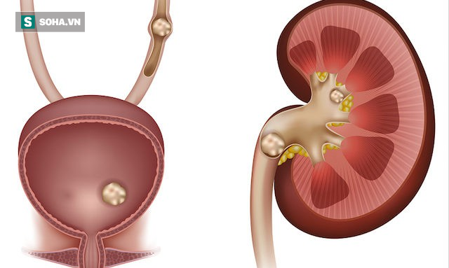 Thận có khỏe thì mệnh mới an: 8 việc bạn cần làm ngay để giữ cho thận không bị suy kiệt - Ảnh 1. Thận có khỏe thì mệnh mới an: 8 việc bạn cần làm ngay để giữ cho thận không bị suy kiệt - Ảnh 1.