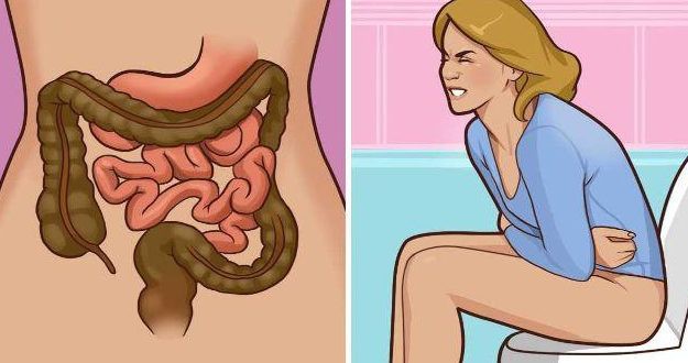 Báo động ung thư đại trực tràng trẻ hoá, 12 tuổi đã mắc: Có dấu hiệu này cần khám ngay - Ảnh 1. Báo động ung thư đại trực tràng trẻ hoá, 12 tuổi đã mắc: Có dấu hiệu này cần khám ngay - Ảnh 1.