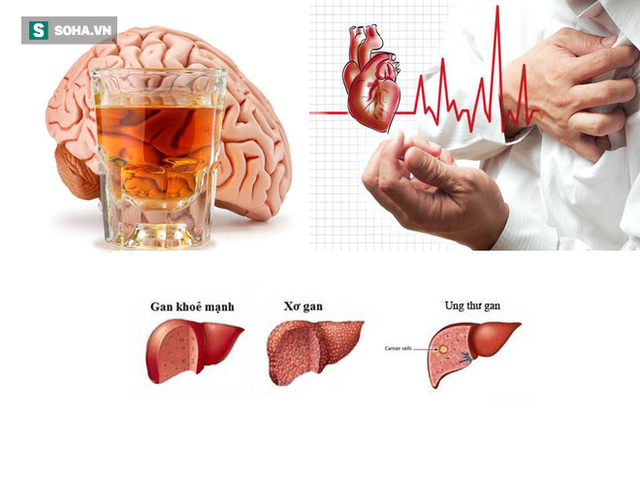 Uống rượu bia thường xuyên: 5 cơ quan nội tạng bốc hơi đáng giật mình - Ảnh 1. Uống rượu bia thường xuyên: 5 cơ quan nội tạng bốc hơi đáng giật mình - Ảnh 1.