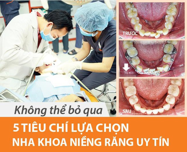 Địa chỉ niềng răng uy tín: 5 tiêu chí chọn nha khoa bạn nên biết - Ảnh 1. Địa chỉ niềng răng uy tín: 5 tiêu chí chọn nha khoa bạn nên biết - Ảnh 1.