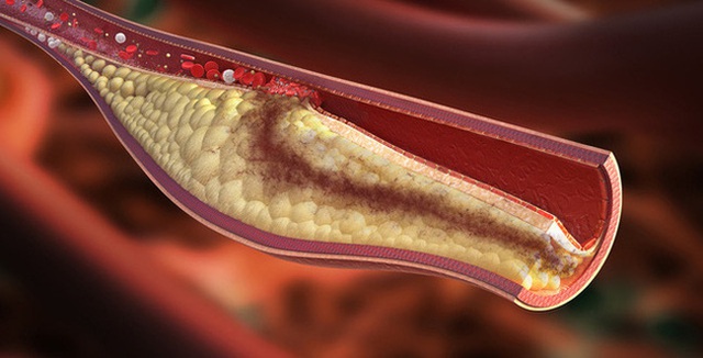 8 món ăn vặt dành riêng cho người có cholesterol cao, vừa rẻ bèo lại còn giàu dinh dưỡng - Ảnh 1. 8 món ăn vặt dành riêng cho người có cholesterol cao, vừa rẻ bèo lại còn giàu dinh dưỡng - Ảnh 1.
