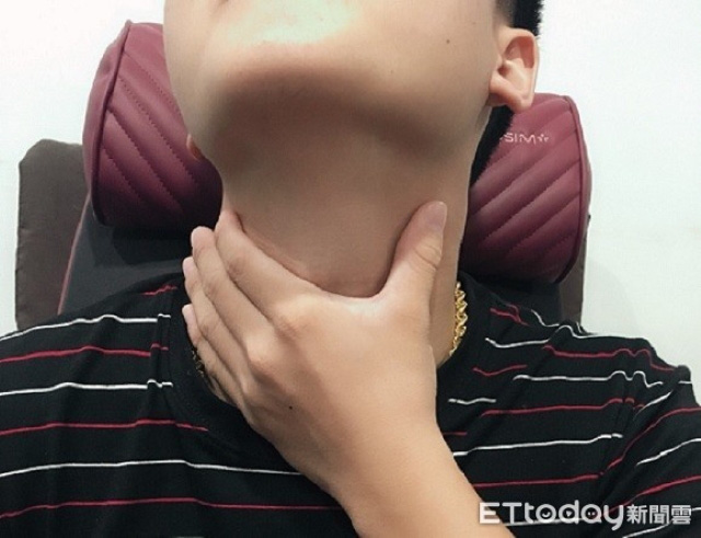 Nấc và táo bón là do rối loạn tiêu hóa, nhưng cũng có thể là dấu hiệu cảnh báo ung thư, chàng trai này là một bệnh nhân trong số đó - Ảnh 1. Nấc và táo bón là do rối loạn tiêu hóa, nhưng cũng có thể là dấu hiệu cảnh báo ung thư, chàng trai này là một bệnh nhân trong số đó - Ảnh 1.