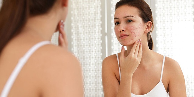 2 cách đơn giản nhất bạn có thể kiểm tra tại nhà để biết mình có bị ung thư tuyến giáp hay không - Ảnh 1. 2 cách đơn giản nhất bạn có thể kiểm tra tại nhà để biết mình có bị ung thư tuyến giáp hay không - Ảnh 1.