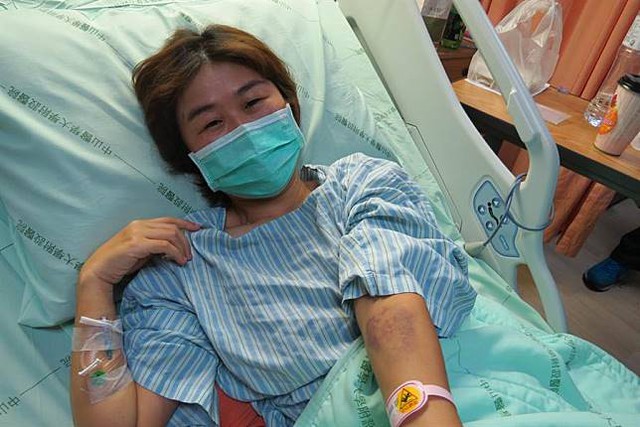 Bị ung thư phổi, cô gái khóc nấc khi lỡ chủ quan bỏ qua dấu hiệu nguy hiểm này ở ngón tay - Ảnh 1. Bị ung thư phổi, cô gái khóc nấc khi lỡ chủ quan bỏ qua dấu hiệu nguy hiểm này ở ngón tay - Ảnh 1.