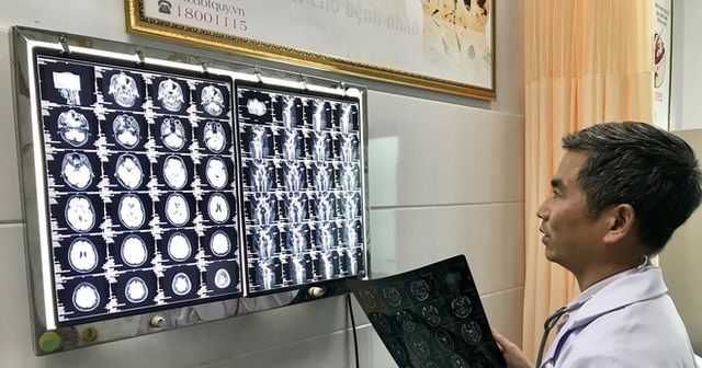 Đột quỵ không còn là bệnh trời kêu ai nấy dạ: Cách để phòng ngừa 80% nguy cơ đột quỵ - Ảnh 1. Đột quỵ không còn là bệnh trời kêu ai nấy dạ: Cách để phòng ngừa 80% nguy cơ đột quỵ - Ảnh 1.