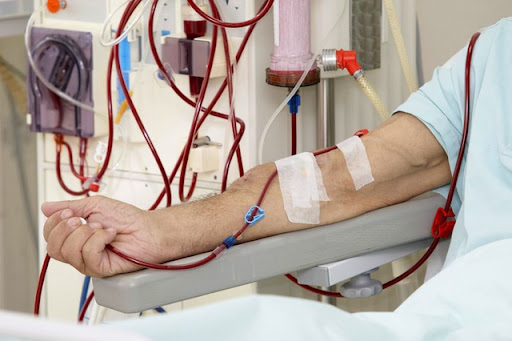 Đang khoẻ chỉ 1 lần lăn ra ốm, đi khám đã suy thận giai đoạn cuối: BS chỉ ra nguyên nhân - Ảnh 1. Đang khoẻ chỉ 1 lần lăn ra ốm, đi khám đã suy thận giai đoạn cuối: BS chỉ ra nguyên nhân - Ảnh 1.
