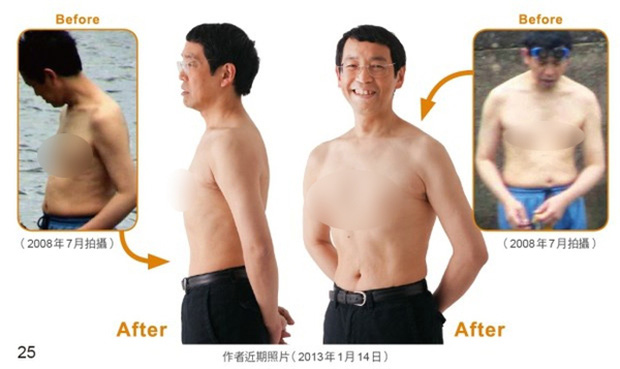 Bác sĩ người Nhật chỉ cách đi bộ và hít thở sương sương cũng giảm được 10kg, ai đang cần siết cân thì phải thử ngay - Ảnh 1. Bác sĩ người Nhật chỉ cách đi bộ và hít thở sương sương cũng giảm được 10kg, ai đang cần siết cân thì phải thử ngay - Ảnh 1.
