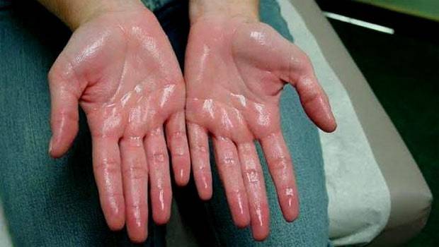 Khi nam giới ngủ, 3 vùng này trên cơ thể đổ mồ hôi nhiều ngầm cảnh báo thận đang bị tổn thương - Ảnh 1. Khi nam giới ngủ, 3 vùng này trên cơ thể đổ mồ hôi nhiều ngầm cảnh báo thận đang bị tổn thương - Ảnh 1.