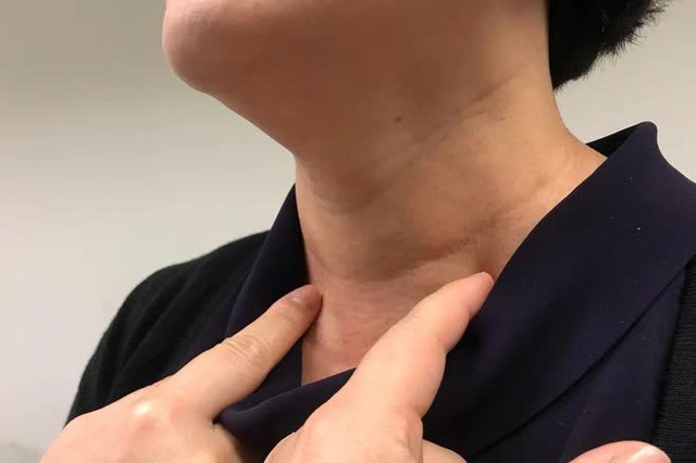 Hầu hết những người bị polyp, nốt sần trên cơ thể đều có 5 thói quen xấu này, nếu bạn cũng có nên bỏ ngay - Ảnh 1. Hầu hết những người bị polyp, nốt sần trên cơ thể đều có 5 thói quen xấu này, nếu bạn cũng có nên bỏ ngay - Ảnh 1.