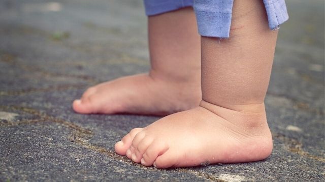 Dép Crocs gây tật bàn chân bẹt hay không? Chuyên gia giải đáp ngắn gọn, bất ngờ - Ảnh 1. Dép Crocs gây tật bàn chân bẹt hay không? Chuyên gia giải đáp ngắn gọn, bất ngờ - Ảnh 1.